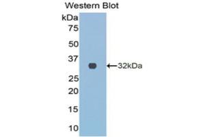 Western Blotting (WB) image for anti-Collagen, Type III, alpha 1 (COL3A1) (AA 1171-1435) antibody (ABIN1077676) (COL3A1 anticorps  (AA 1171-1435))