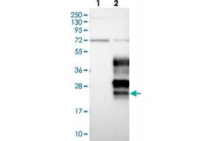 Western blot analysis of Lane 1: Negative control (vector only transfected HEK293T lysate), Lane 2: Over-expression Lysate (Co-expressed with a C-terminal myc-DDK tag (~3. (OPALIN anticorps)