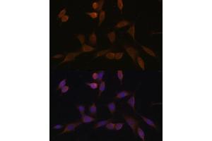 anti-NADH Dehydrogenase (Ubiquinone) 1 alpha Subcomplex, 5, 13kDa (NDUFA5) (AA 1-116) antibody