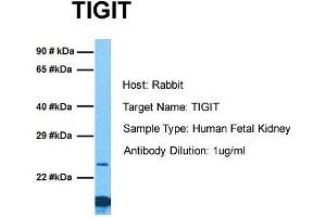 Host: Rabbit Target Name: TIGIT Sample Tissue: Human Fetal Kidney Antibody Dilution: 1. (TIGIT anticorps  (C-Term))