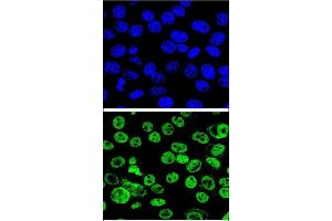 Confocal immunofluorescent analysis of MDM2 Antibody  (ABIN388067 and ABIN2845752) with Hela cell followed by Alexa Fluor® 488-conjugated goat anti-rabbit lgG (green). (MDM2 anticorps  (AA 141-176))