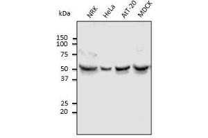 Anti-Tubulin alpha4A Ab at 1,000 dilution, lysates at 100 µg per Iane, Rabbit polyclonal to goat IgG (HRP) at 1/10,000 dilution.