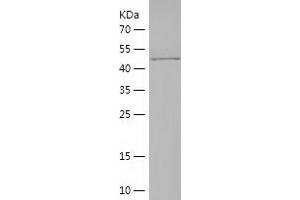 Myosin Heavy Chain 2, Skeletal Muscle, Adult (MYH2) (AA 22-304) protein (His-IF2DI Tag)