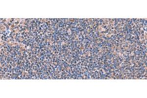 Immunohistochemistry of paraffin-embedded Human tonsil tissue using PEPD Polyclonal Antibody at dilution of 1:70(x200) (PEPD anticorps)