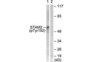 Western blot analysis of extracts from NIH-3T3 cells treated with EGF 200ng/ml 30', using STAM2 (Phospho-Tyr192) Antibody. (STAM2 anticorps  (pTyr192))