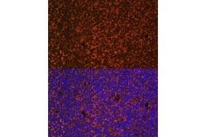 Immunofluorescence analysis of mouse embryos cells using PTCH1 antibody (ABIN1682368, ABIN1682367, ABIN3015342, ABIN3015343 and ABIN6213997) at dilution of 1:100. (Patched 1 anticorps  (AA 1214-1312))