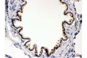 IHC testing of FFPE rat lung with BMP5 antibody. (BMP5 anticorps)
