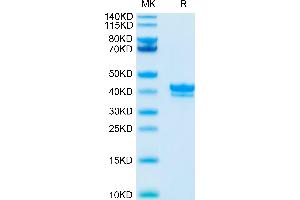 Cynomolgus BCMA on Tris-Bis PAGE under reduced condition.