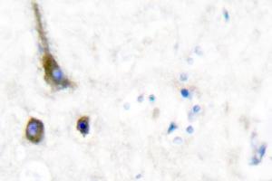 Image no. 1 for anti-Potassium Voltage-Gated Channel, Shaw-Related Subfamily, Member 2 (KCNC2) antibody (ABIN271788) (KCNC2 anticorps)