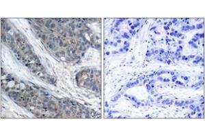 Immunohistochemistry (IHC) image for anti-Insulin Receptor Substrate 1 (IRS1) (pSer307) antibody (ABIN2888447) (IRS1 anticorps  (pSer307))