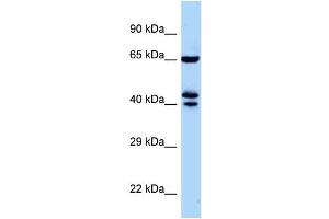 WB Suggested Anti-Zfp583 Antibody Titration: 1. (ZNF583 anticorps  (Middle Region))