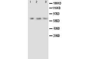 Anti-Angiopoietin 2 antibody, Western blotting Lane 1: Recombinant Human ANG2 Protein 10ng Lane 2: Recombinant Human ANG2 Protein 5ng Lane 3: Recombinant Human ANG2 Protein 2. (Angiopoietin 2 anticorps  (C-Term))