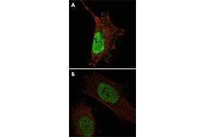 Confocal immunofluorescence analysis of cells using MDM4 monoclonal antobody, clone 2D10F4  (green). (MDM4-binding Protein anticorps)