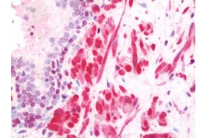 Anti-TAGLN / Transgelin / SM22 antibody IHC staining of human prostate. (Transgelin anticorps  (HRP))