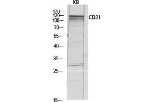 Western Blot (WB) analysis of KB lysis using CD31 antibody.