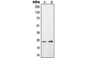 Western blot analysis of OTUB2 expression in HeLa (A), HepG2 (B) whole cell lysates. (OTUB2 anticorps  (Center))