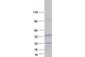 Validation with Western Blot