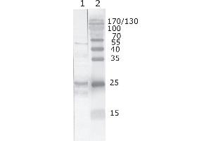 Western Blot testing of HIV-1 recombinant Tat protein. (HIV-1 Tat anticorps  (AA 71-81))