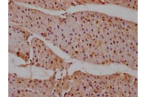 IHC image of ABIN7127807 diluted at 1:100 and staining in paraffin-embedded human heart tissue performed on a Leica BondTM system.