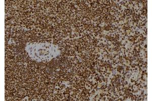 ABIN6268644 at 1/100 staining Rat spleen tissue by IHC-P. (JAK1 anticorps)