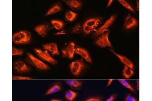 Immunofluorescence analysis of U2OS cells using DPP4 Polyclonal Antibody at dilution of 1:100. (DPP4 anticorps)