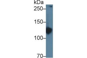 Western Blot; Sample: Rat Serum; Primary Ab: 1µg/ml Rabbit Anti-Rat AMPH Antibody Second Ab: 0. (Amphiphysin anticorps  (AA 24-240))