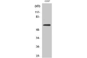 Western Blotting (WB) image for anti-Nuclear Receptor Subfamily 4, Group A, Member 1 (NR4A1) (Ser351) antibody (ABIN5961748)