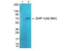 Western blot analysis of extracts from JK cells (Lane 2), using SHP-1 (Ab-564) antiobdy. (MSK1 anticorps  (C-Term))