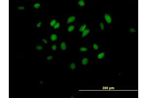 Immunofluorescence of purified MaxPab antibody to MXD3 on HeLa cell. (MXD3 anticorps  (AA 1-206))