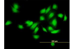 Immunofluorescence of monoclonal antibody to CAMK2A on HeLa cell. (CAMK2A anticorps  (AA 305-410))