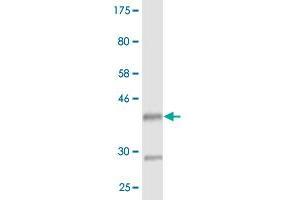 Western Blot detection against Immunogen (36. (HOXD3 anticorps  (AA 334-431))
