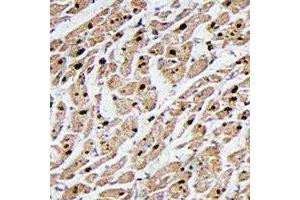 Immunohistochemical analysis of MAPKAPK3 staining in human heart formalin fixed paraffin embedded tissue section.
