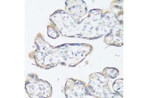 Immunohistochemistry of paraffin-embedded human placenta using Src antibody (ABIN6132240, ABIN6148428, ABIN6148429 and ABIN6215399) at dilution of 1:100 (40x lens).