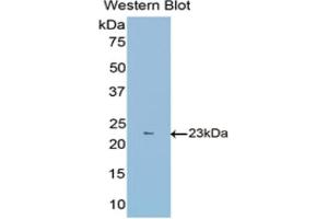 Detection of Recombinant FBLN1, Mouse using Polyclonal Antibody to Fibulin 1 (FBLN1) (Fibulin 1 anticorps  (AA 399-578))