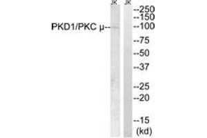 Western blot analysis of extracts from Jurkat cells, using PKD1/PKC mu (Ab-910) Antibody. (PKC mu anticorps  (AA 863-912))