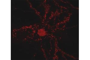 Indirect immunolabeling of cultured rat hippocampus neurons (dilution 1 : 500)