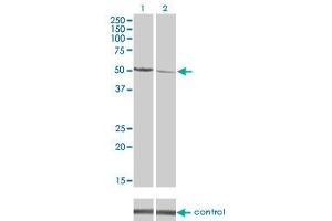 Western blot analysis of CAMK2D over-expressed 293 cell line, cotransfected with CAMK2D Validated Chimera RNAi (Lane 2) or non-transfected control (Lane 1). (CAMK2D anticorps  (AA 301-410))