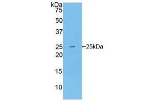 Western blot analysis of recombinant Human NOS1. (NOS1 anticorps  (AA 1199-1399))