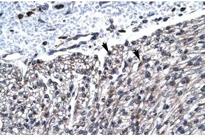 Immunohistochemistry (IHC) image for anti-Hematopoietic Cell-Specific Lyn Substrate 1 (HCLS1) (N-Term) antibody (ABIN2777503)