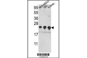 Western blot analysis of PRDX2 Antibody in MDA-MB231,293 cell line and mouse brain tissue lysates (35ug/lane)(2ug/ml) (Peroxiredoxin 2 anticorps  (C-Term))