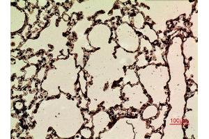 Immunohistochemistry (IHC) analysis of paraffin-embedded Rat Lung, antibody was diluted at 1:100.