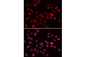 Immunofluorescence analysis of U2OS cells using CHRM5 antibody (ABIN5973103). (CHRM5 anticorps)