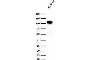 Western Blot Analysis of human Kidney lysate using KSP-Cadherin Rabbit Recombinant Monoclonal Antibody (CDH16/1532R)