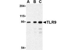 Western blot analysis of TLR9 in Jurkat cell lysate with this product at (A) 0. (TLR9 anticorps  (Center))