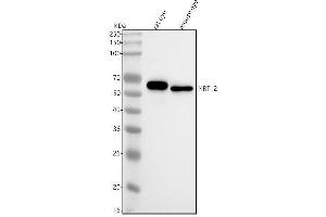 Western blot analysis of KRT12 using anti-KRT12 antibody (ABIN7604584).