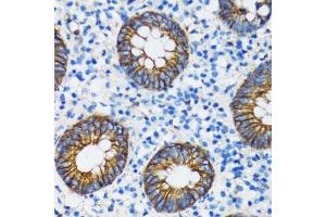 Immunohistochemistry of paraffin-embedded human vermiform appendix using CTNNA1 antibody.