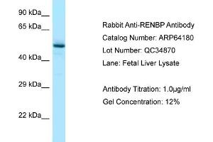 Western Blotting (WB) image for anti-Renin Binding Protein (RENBP) (N-Term) antibody (ABIN2789758) (RENBP anticorps  (N-Term))