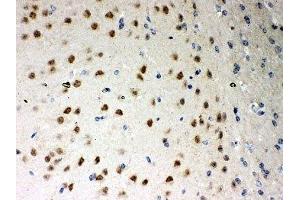 IHC-P: PKC iota antibody testing of mouse brain tissue (PKC iota anticorps  (AA 21-214))
