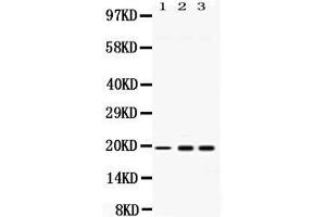 Western blot analysis of PC4 expression in rat liver extract ( Lane 1), HELA whole cell lysates ( Lane 2) and U2OS whole cell lysates ( Lane 3). (SUB1 anticorps  (C-Term))