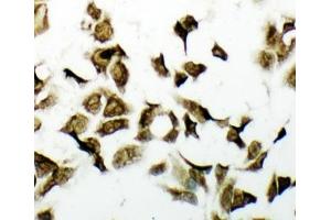 ICC testing of PDK2 antbody and HeLa cells (PDK2 anticorps  (C-Term))